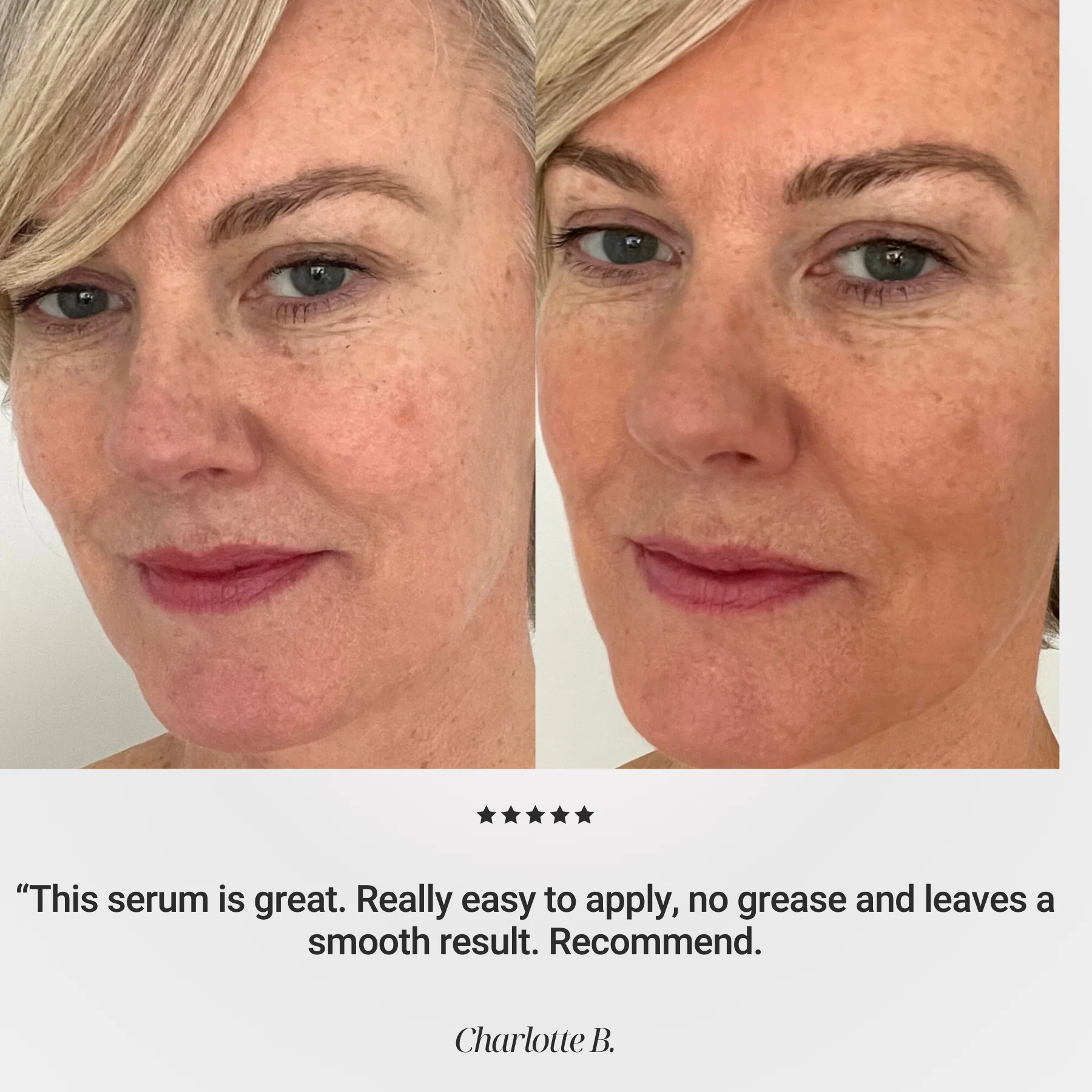 THE ANTI AGE FACE SERUM - Image 4