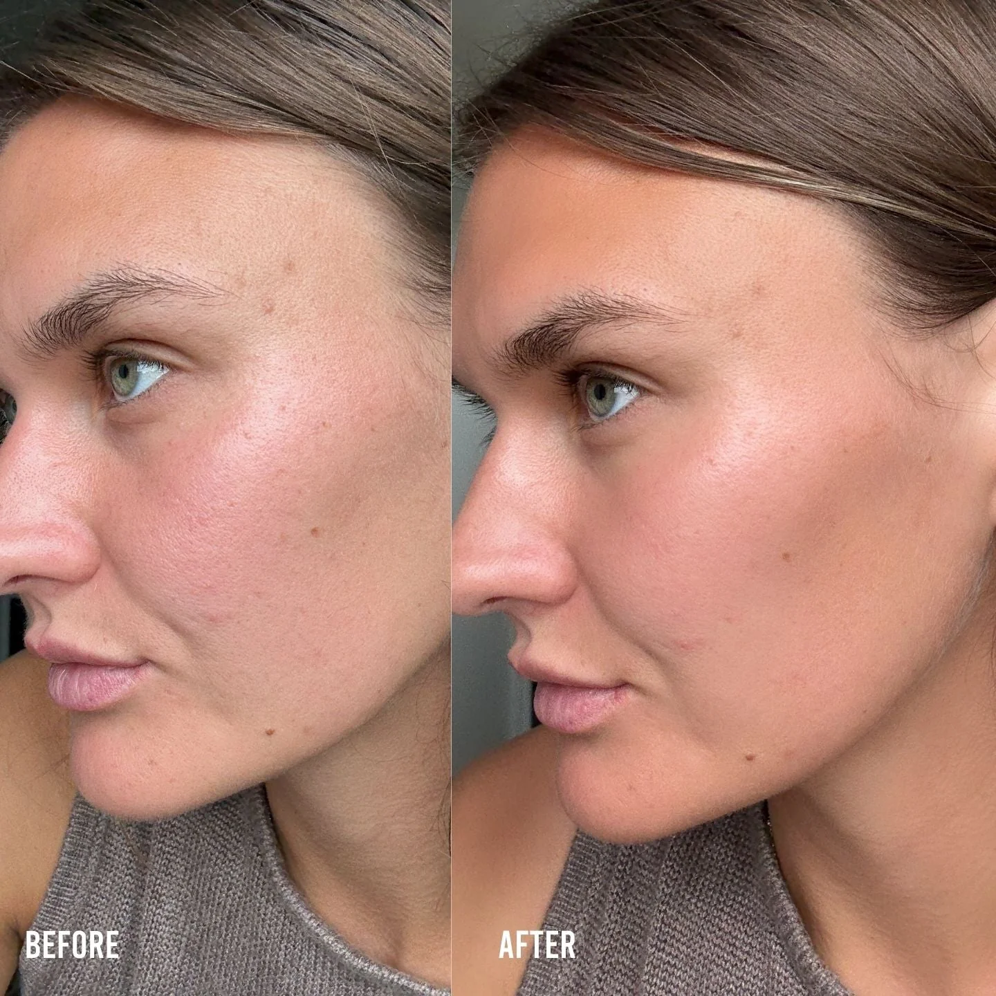 MEDIUM SKIN-ENHANCING GLOW SET - Image 10
